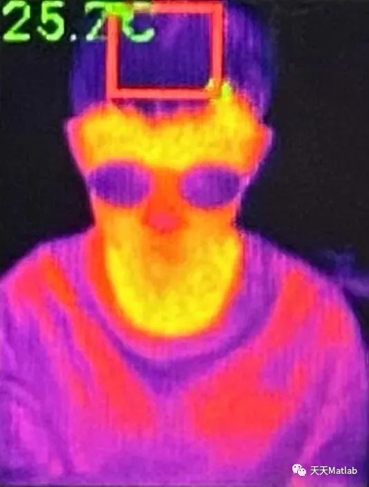 【图像检测】基于计算机视觉实现红外图像的人体特征信息检测Matlab源码