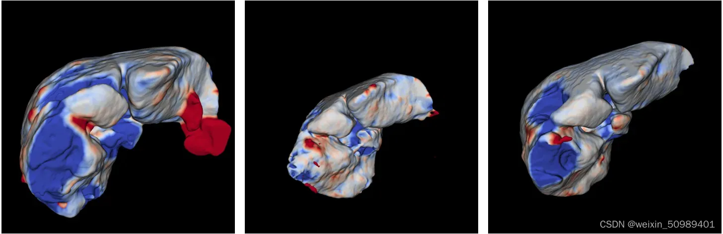 医学图像分割之肝脏分割（2D）