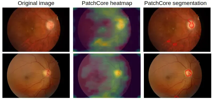 使用 PatchCore 进行图像异常检测